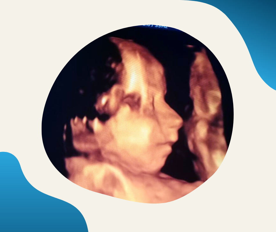 atlascare baby scan